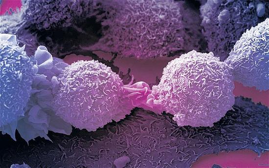 逆转！新技术“关闭”癌变开关 将癌细胞转变为正常细胞