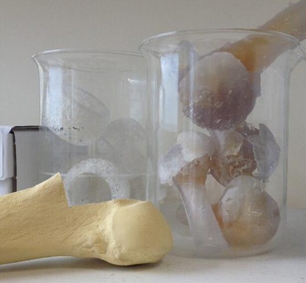 一家3D打印技术用于膝关节和髋关节手术的英国骨科创业公司