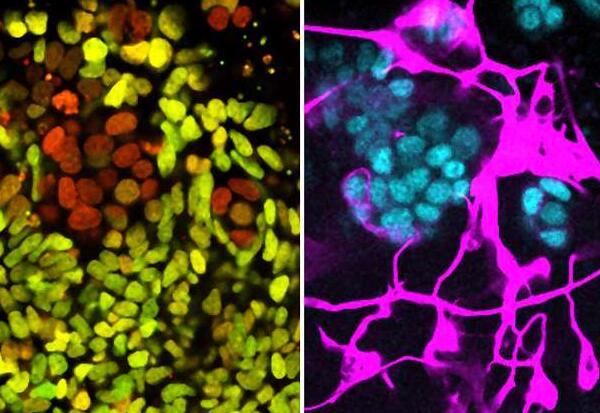 MSB：新研究microRNA-142分子让干细胞永生不变