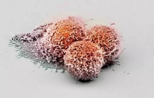 Nature：科学家找到肝癌“抑癌蛋白”，有望带来诊疗新思路