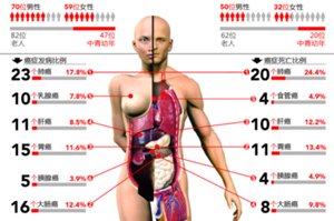 上海平均每天82人死于癌症 治疗费4成用在最后一年