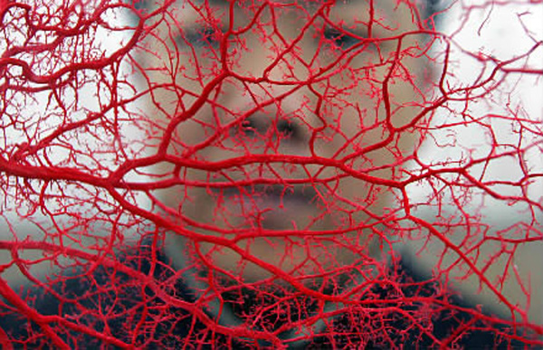 3D打印人工血管在美国问世