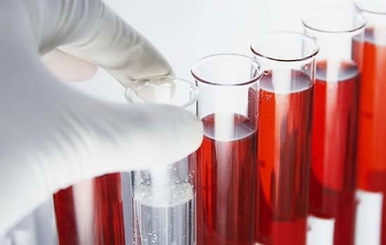 发现800多种血液标记 一次验血有望检测多种癌症