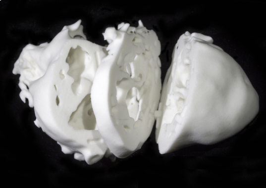 3D打印在复杂心脏治疗诊断中的作用