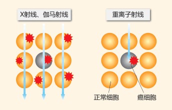 综述肿瘤质子和重离子治疗技术