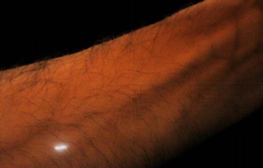 Profusa：注射到体内与细胞共生  随时追踪健康数据