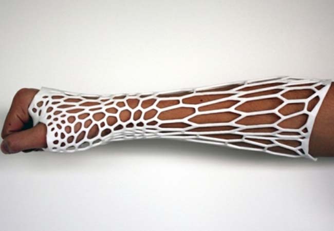 骨科3D打印高速发展 审批成最大关卡 