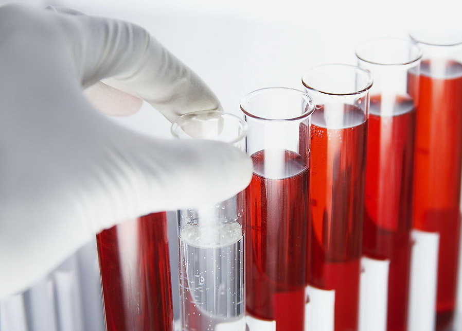 新验血法能快速检出细菌病毒 不需要抗生素