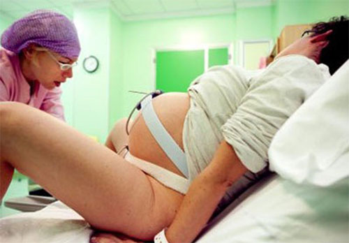 程控硬膜外间歇脉冲注入技术（PIEB） 一种让分娩不再“痛”的麻醉术