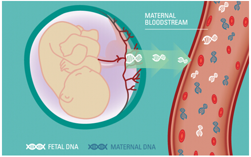 英国和荷兰报告无创产前检测的最新成果
