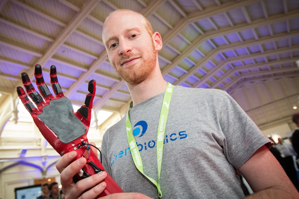 Open Bionics：制造低价的3D 打印机器手