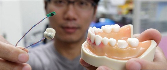 太神奇了！谷歌智能牙齿还能动作识别？