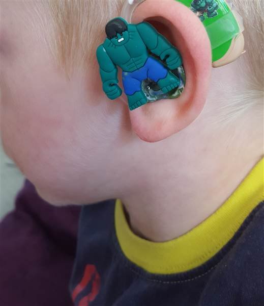 绿巨人 蝙蝠侠 专属孩子的炫酷助听器