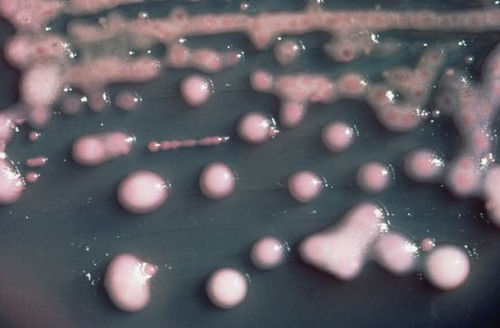 美国华盛顿大学发现“超级细菌”失去耐药性