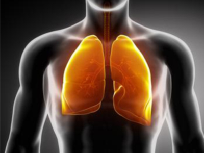 FDA：针对转移性肺癌的一线靶向疗法Iressa获批准