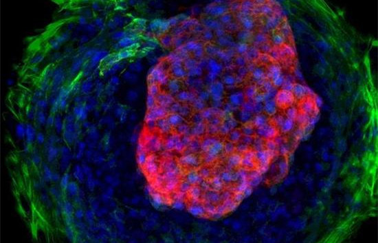 干细胞制造可跳动人工心脏：与心脏同尺寸