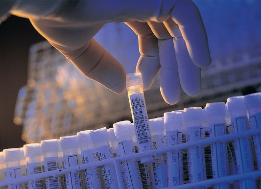 中国首个E-BioBank平台下生物资源“样本库目录”上线