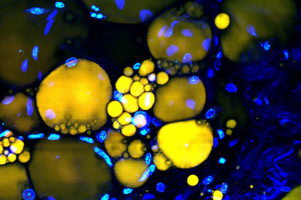 Nature子刊：生物激光器“点亮”细胞 有望破解癌变机理