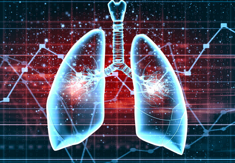 Nature：肺动脉高压守护者——特定基因
