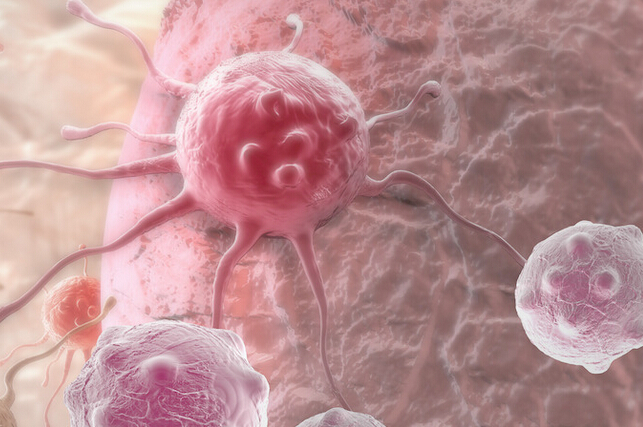  医学里程碑：科学家发现方法将癌细胞转为良性