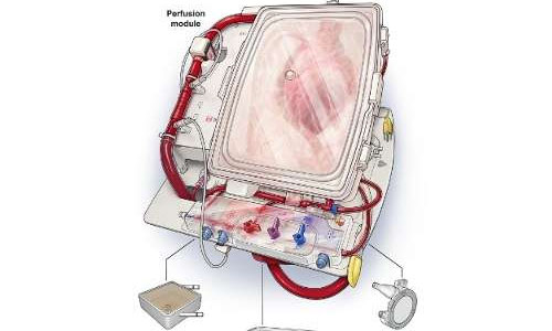 新技术：救生系统可使体外心脏保持跳动