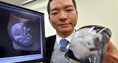 数字化医疗3D打印应用于肿瘤治疗