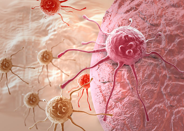 微型植入器：癌症游走细胞 逮住你没商量