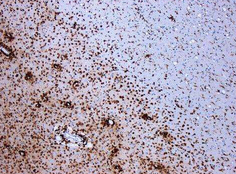 Cell：褪黑激素为多发性硬化症患者机体免疫反应的调节因子