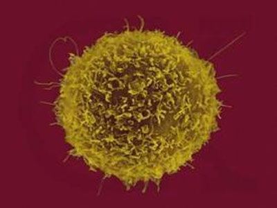 揭开20年未解之谜，我国科学家抓细胞炎性坏死的“杀手”