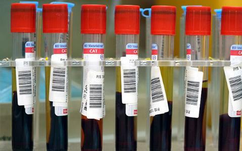 新技术！日本研究团队1小时获知血液中分离出的癌细胞数量