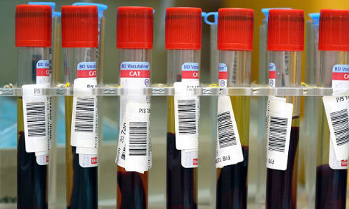 癌症血液检测首次在临床中起作用