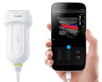 飞利浦推出可插入智能手机的手持超声设备，TOP10医疗设备巨头都有哪些移动医疗智能产品