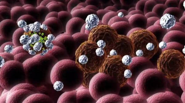 加拿大研发用病毒消灭癌细胞 进入人体临床试验阶段