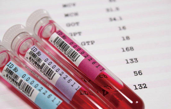 血液检测可发现与遗传性心脏病相关的所有已知基因