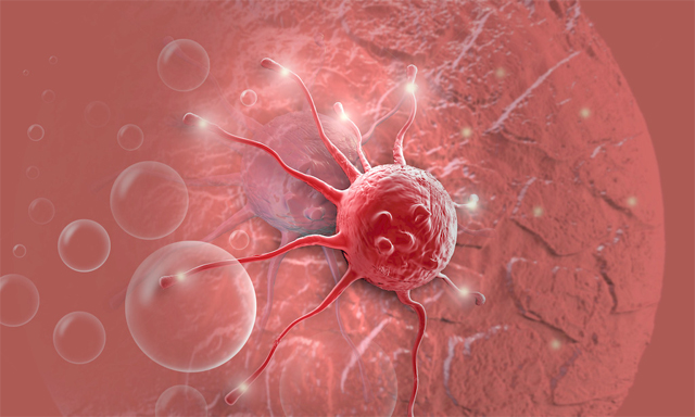 Cancer Research：南京医科大揭示癌细胞对抗癌药替莫唑胺（TMZ）的耐药机制