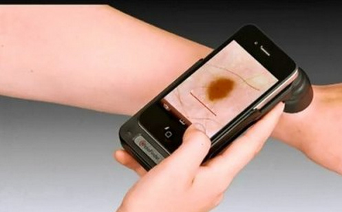 智能手机可以检测皮肤癌？准确率高吗