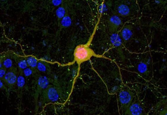Nature：新技术给受损大脑注射神经元修复脑疾病