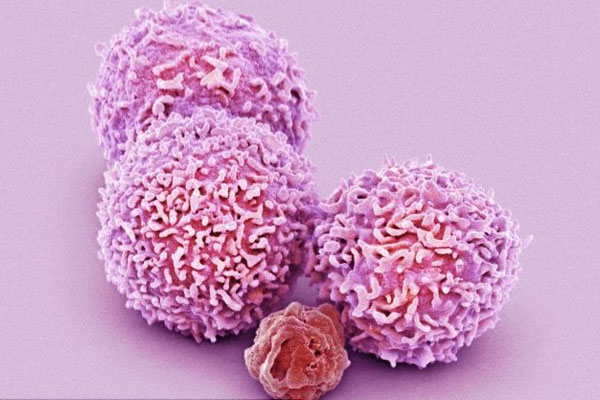 Nature：成功免疫疗法背后的“三要素”