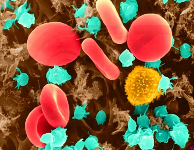 纳米人工红细胞可精准治疗癌症