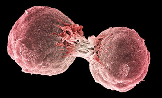 Cell Reports：用肿瘤细胞抗击肿瘤 癌症免疫疗法的新天地