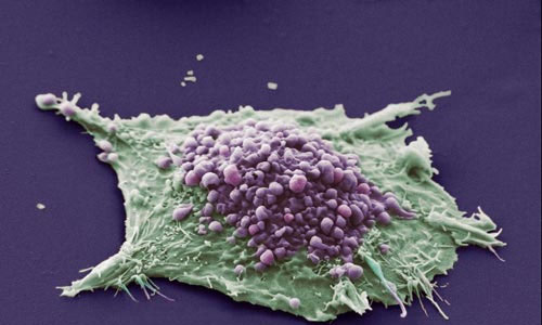 三篇Nature敲定：助力癌细胞“逃生”的新颖代谢途径