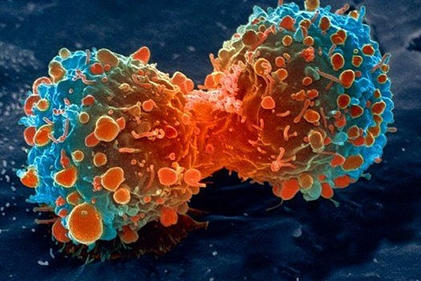 Nature揭示c-Myc的全新功能，或推动癌症免疫疗法