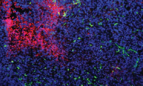 Cell Reports：抗癌新发现，肿瘤细胞可切换“不同模式”