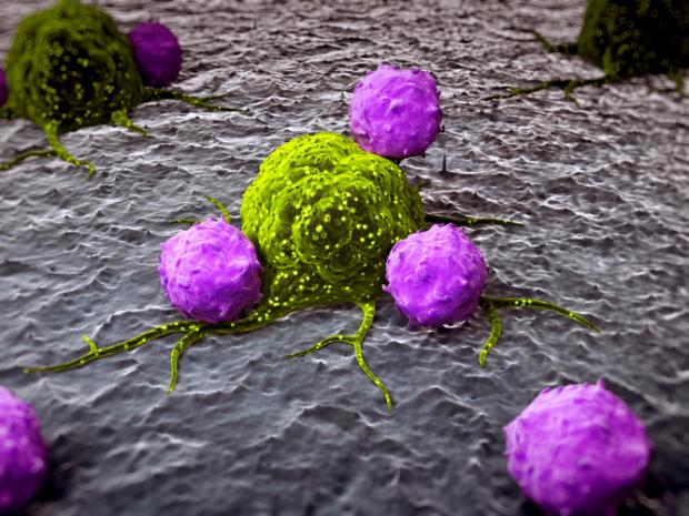 CytoVac公司针对癌症患者研发设计的ALECAST疗法