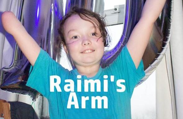 9岁残疾女孩获赠3D打印肌电假手，作者竟是“渐冻人”！