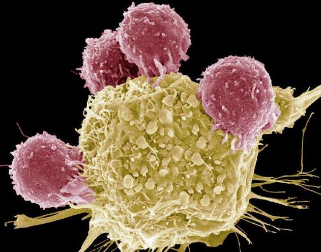 德国科学家找到通过破坏蛋白C-MYC杀死肝癌细胞新方法