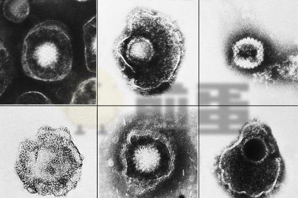 恶贯满盈的疱疹病毒成为了人类的救星