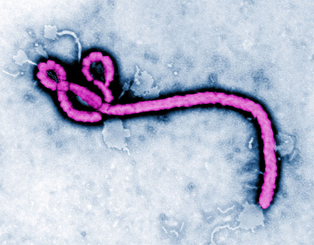 FDA授予强生埃博拉病毒检测试剂盒（Idylla EBOV Test）紧急使用授权（EUA）