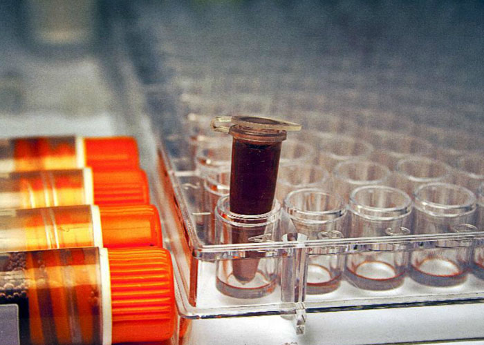 新生物技术公司AIS获4800万美元A轮融资