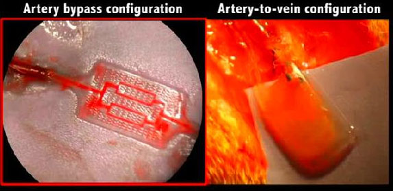 血管组织支架芯片AngioChip，解决人造器官的大难题